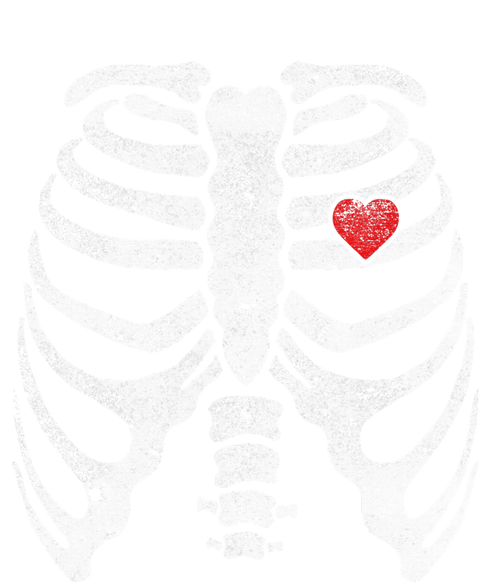 Heart Rib Cage Xray Poster